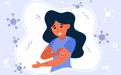 Neurologija – test na tetaniju